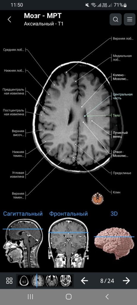 e Anatomy Мозг