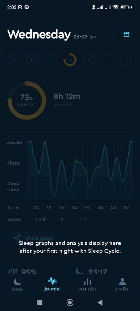 Sleep Cycle Journal